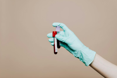 Gloved hand holding two test tubes containing blood samples.