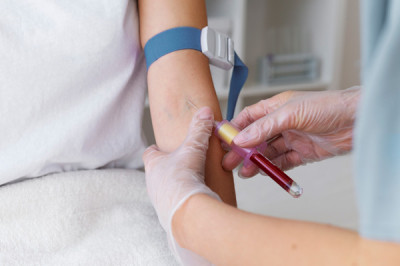 Close-up of a healthcare professional drawing blood from a patient's arm.