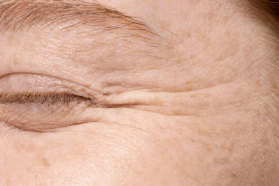 Close-up of closed eye with visible wrinkles and skin texture.