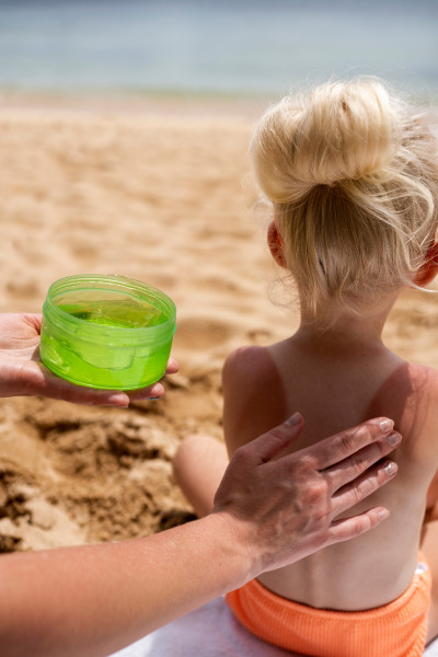 Kind mit Sonnenbrand am Rücken, am Strand sitzend, während Aloe-Gel aufgetragen wird.